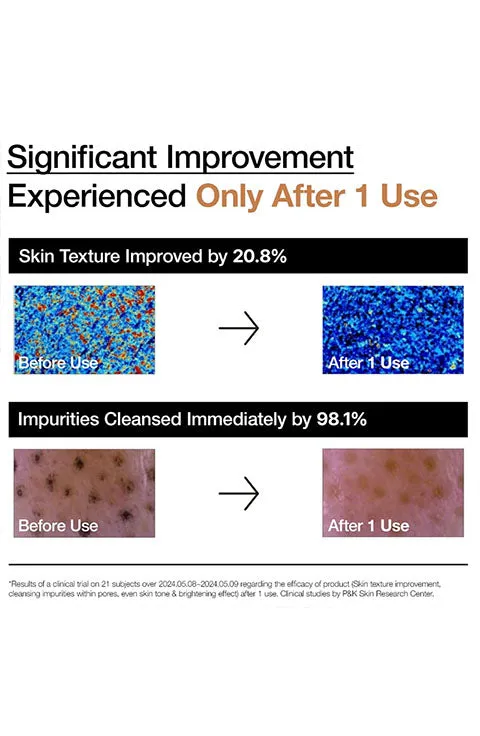 [Anua] Rice Enzyme Brightening Cleansing Powder (40g/1.41fl/oz)