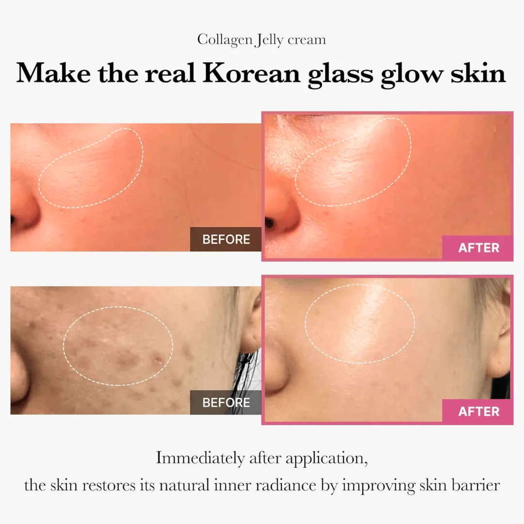 Collagen Jelly Cream