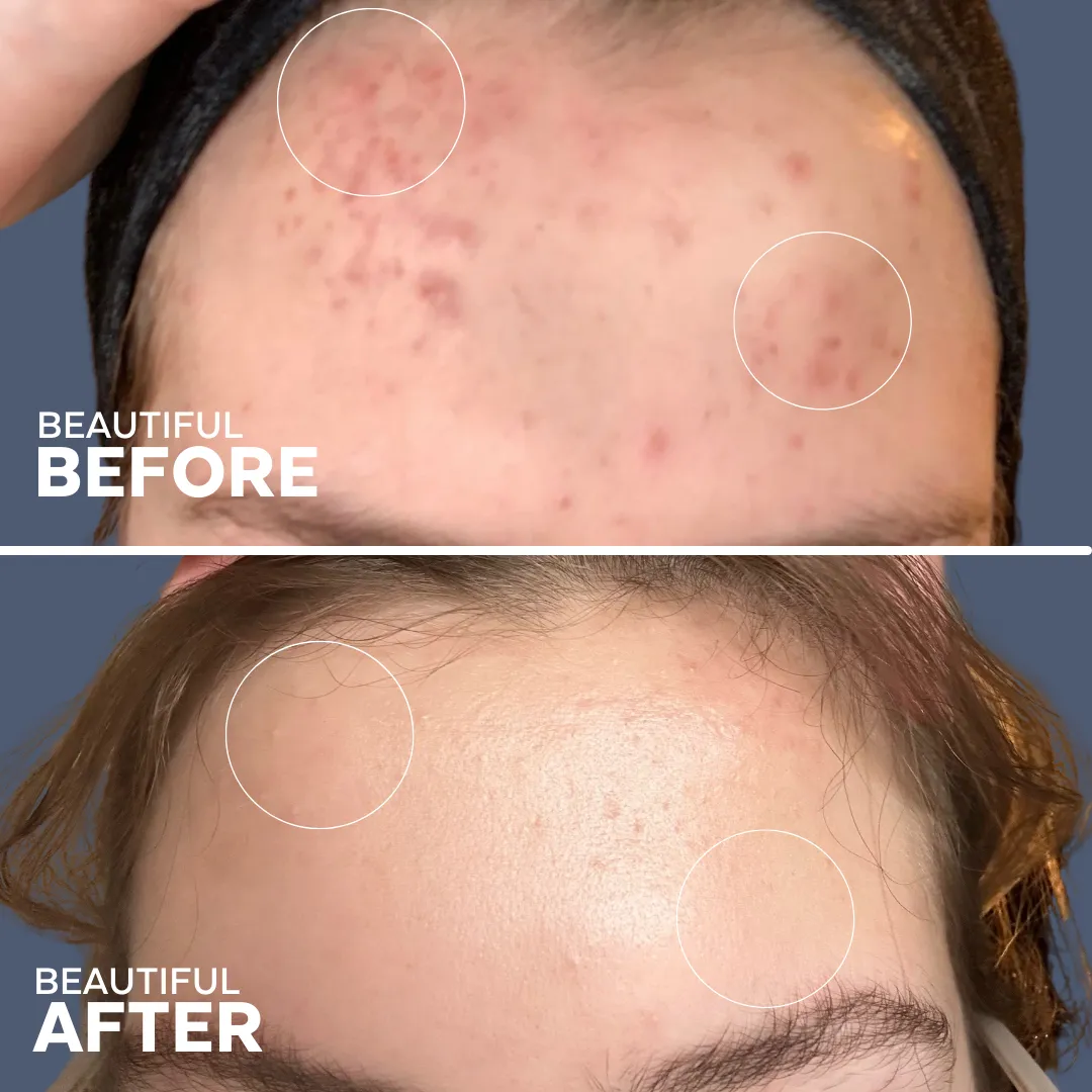 Dew Drops Mushroom Hyaluronic Acid   Vitamin C Serum