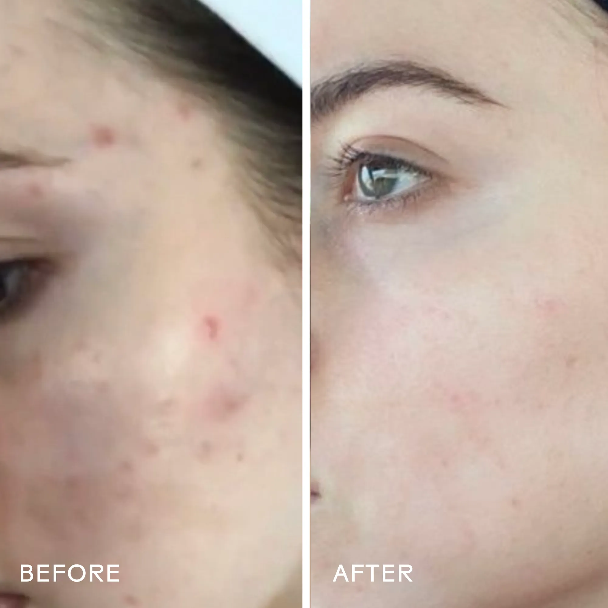 Dew Drops Mushroom   Kakadu Plum Hyaluronic Acid Serum