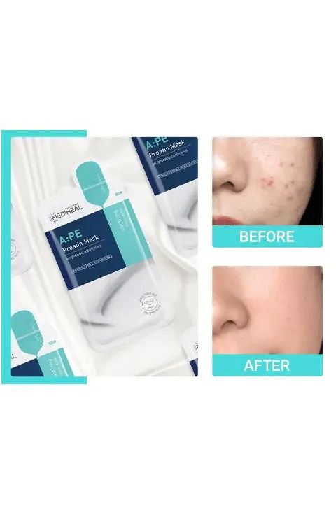[MEDIHEAL] A:PE Proatin Beauty Mask (1Pcs Or 1Box(10Pcs)