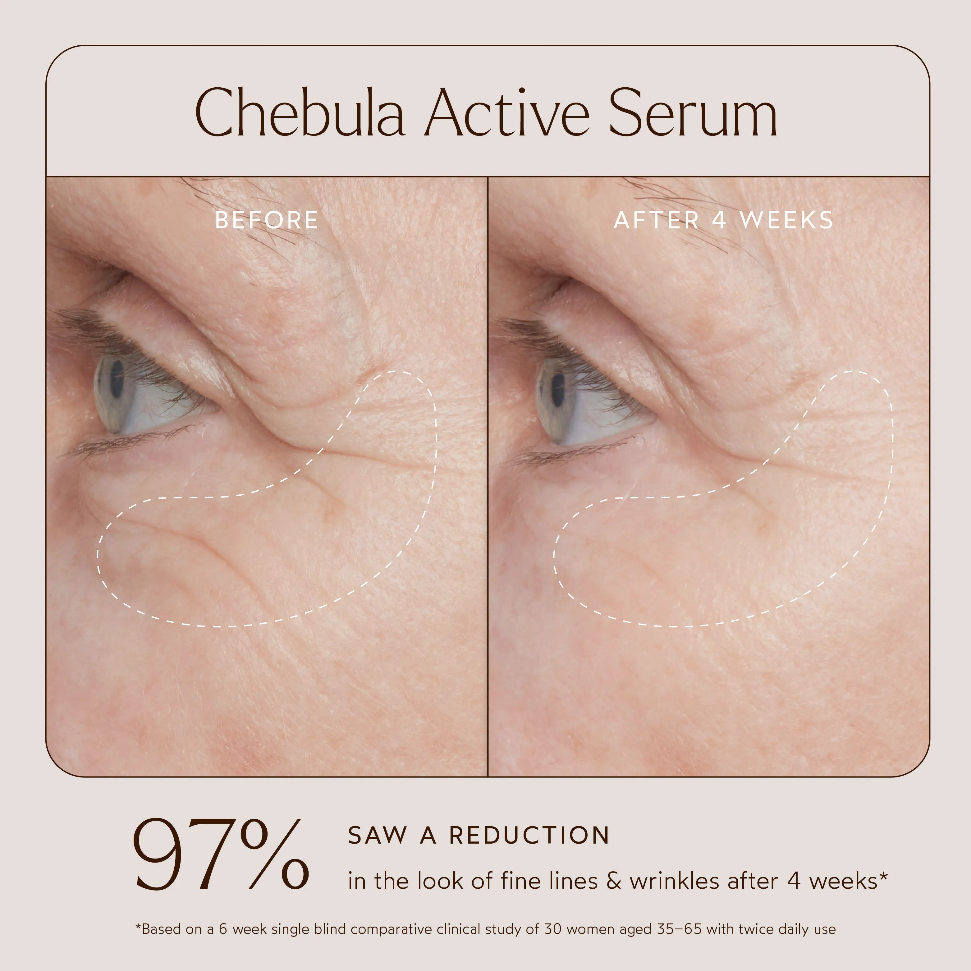 Renew Chebula Active Serum